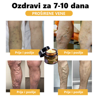 Službena trgovina: Aetheris™ krema za liječenje artritisa s pčelinjim otrovom (preporučeno za starije osobe i AAOS) Posljednji dan sniženo 70% 🎄