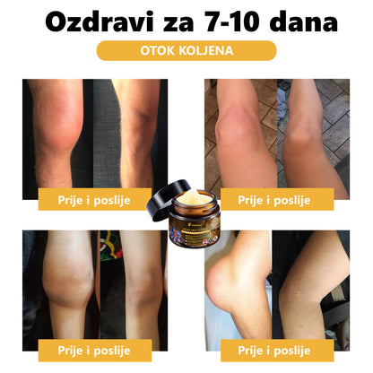 Službena trgovina: Aetheris™ krema za liječenje artritisa s pčelinjim otrovom (preporučeno za starije osobe i AAOS) Posljednji dan sniženo 70% 🎄