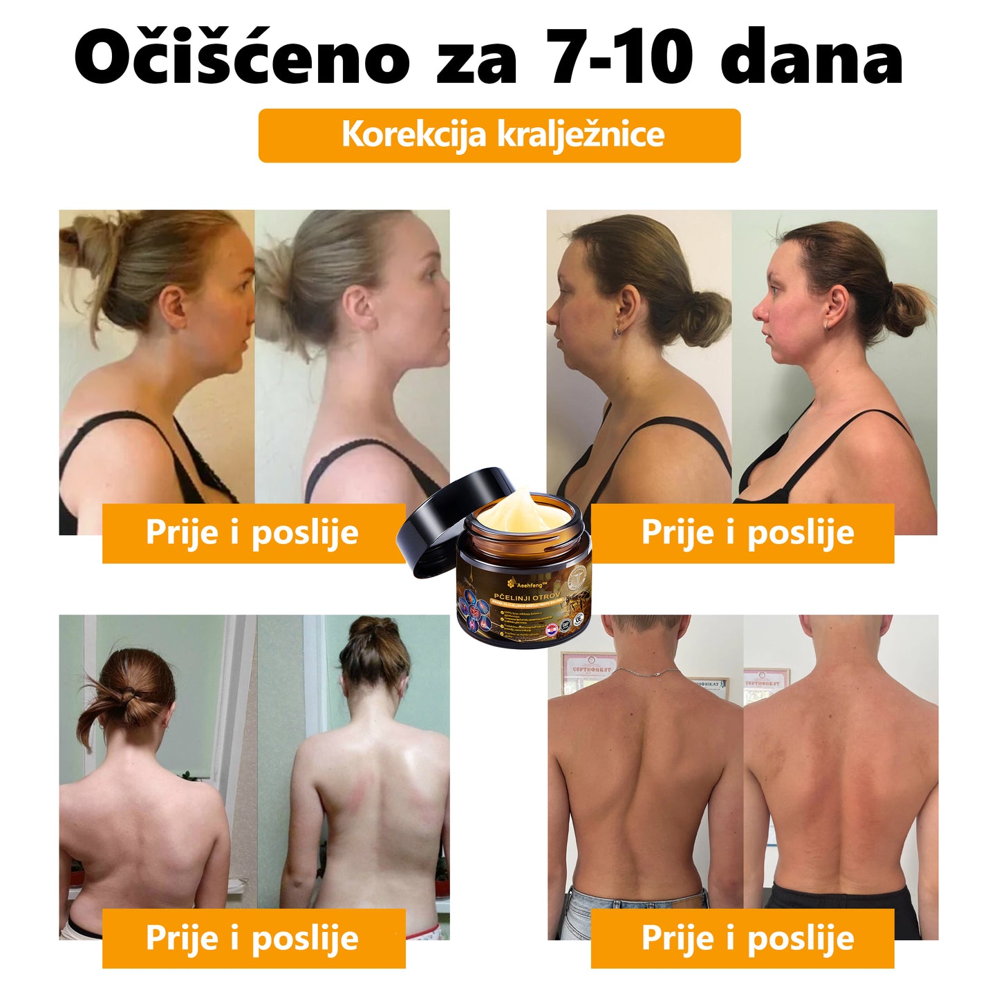 Službena trgovina: Aetheris™ krema za liječenje artritisa s pčelinjim otrovom (preporučeno za starije osobe i AAOS) Posljednji dan sniženo 70% 🎄