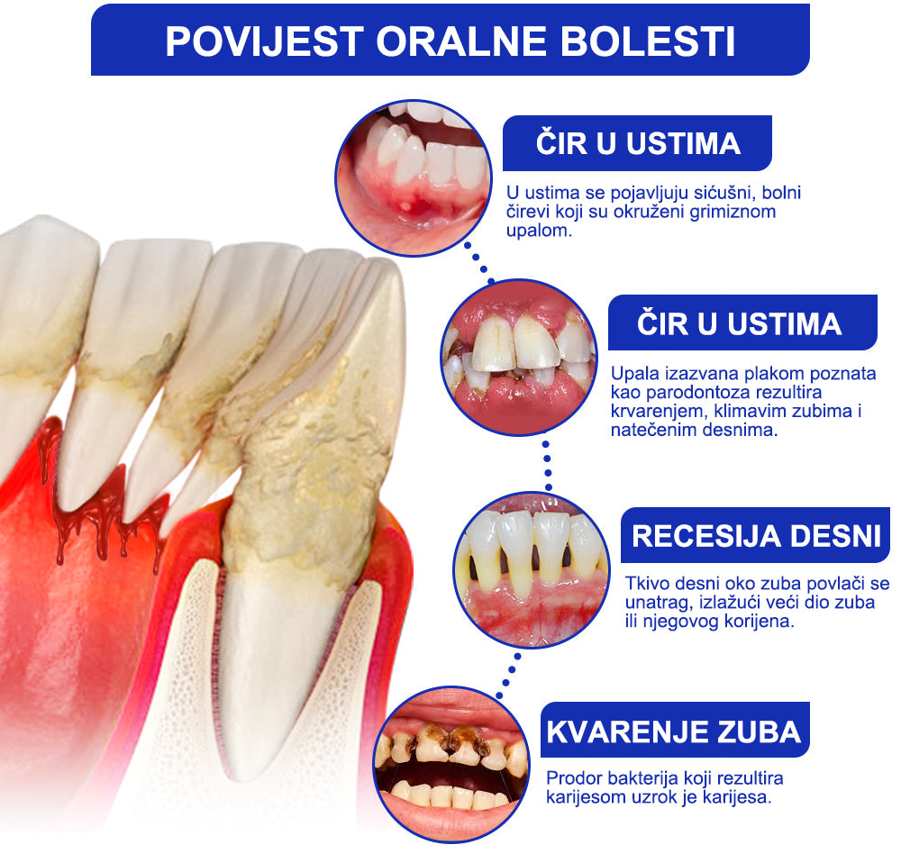 Furzero™ Focussmile tretman s pčelinjim otrovom oralni prah 🦷 (preporučuje CED)🥇