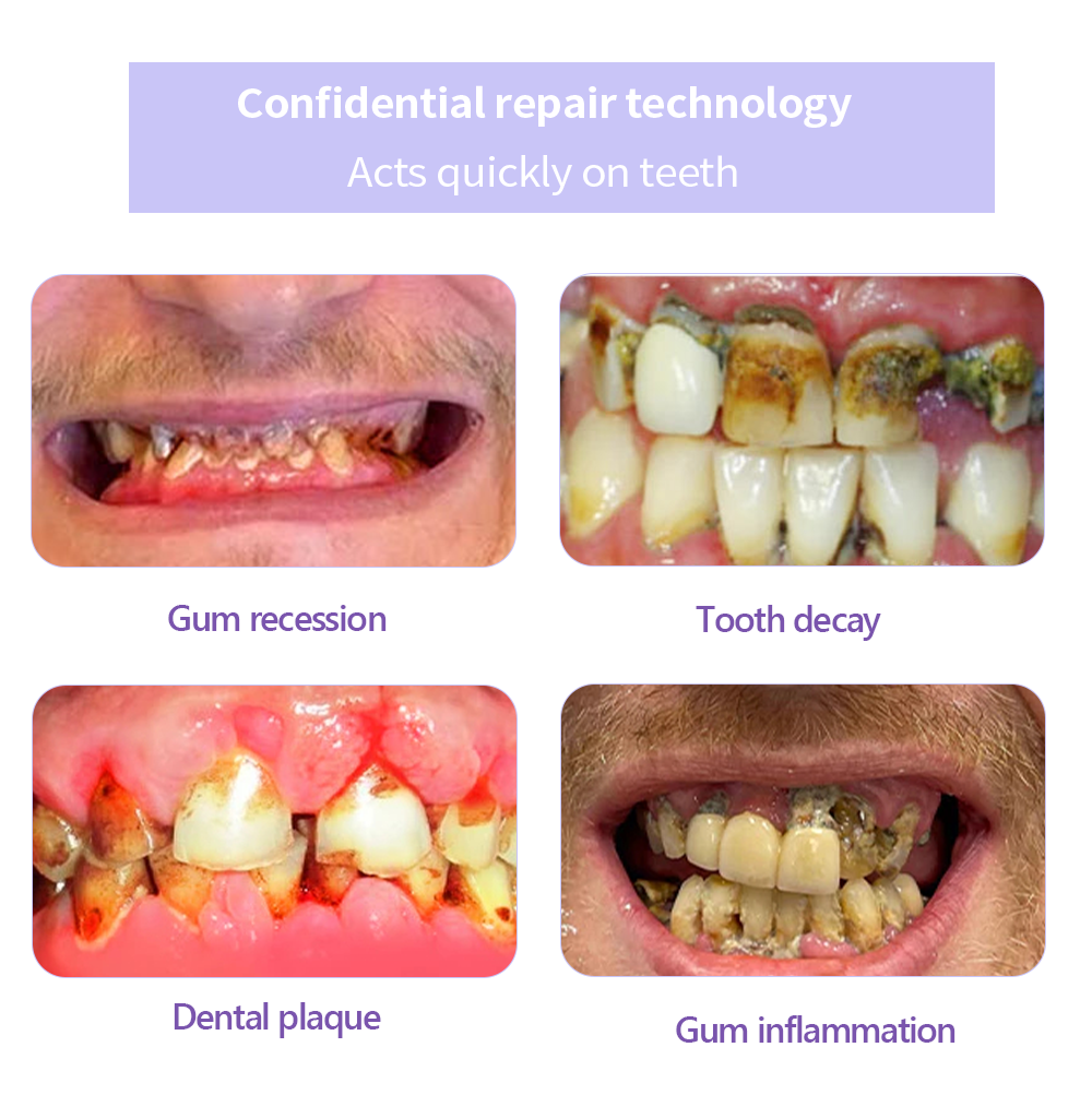 Cvreoz™ (ADA recommended)Teeth Restoration Mineral Powder(😁𝐋𝐢𝐦𝐢𝐭𝐞𝐝 𝐭𝐢𝐦𝐞 𝐝𝐢𝐬𝐜𝐨𝐮𝐧𝐭 𝐋𝐚𝐬𝐭 𝟑𝟎 𝐦𝐢𝐧𝐮𝐭𝐞𝐬😁) ☀️